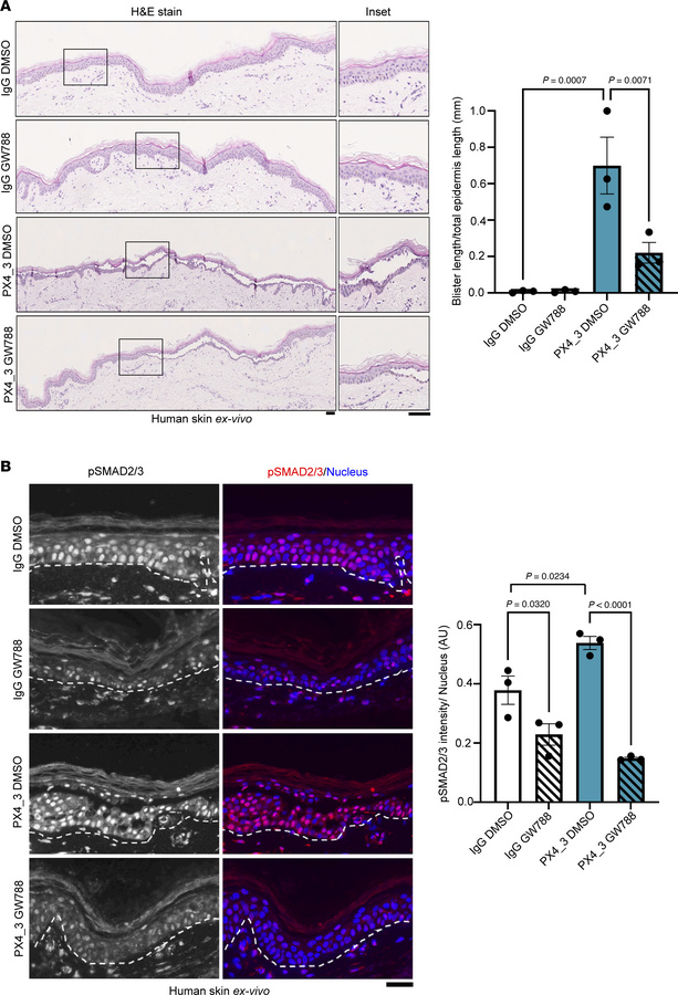 TGF-β inhibition rescues PV-IgG–mediated acantholysis.
(A) H&amp;E stain...