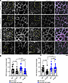 SERPINB5 prevents PV-IgG–mediated DSP rearrangement.