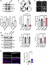 TGF-β signaling is elevated in PV patient samples and modulated by SERPINB5