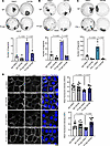 Inhibition of TGF-β signaling rescues PV-IgG–mediated loss of cell-cell adh