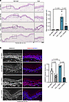 TGF-β inhibition rescues PV-IgG–mediated acantholysis.