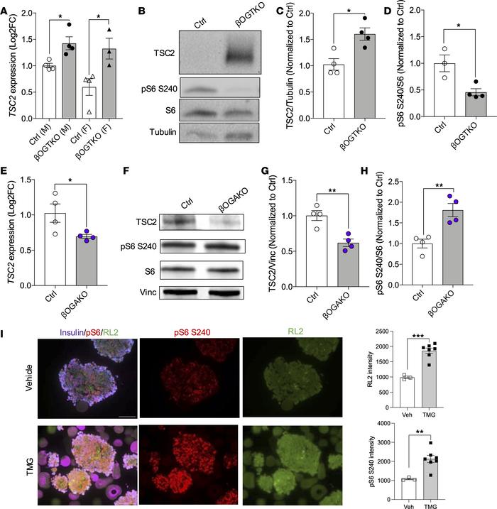 OGT modulates mTORC1 signaling in pancreatic β cells.
(A) qPCR analysis ...