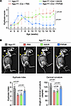 rAAV.PHPeB outperforms rAAV9 in correcting kyphosis.