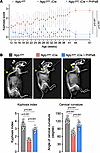 rAAV.PHPeB treatment rescues kyphosis in iNgly1 mice.