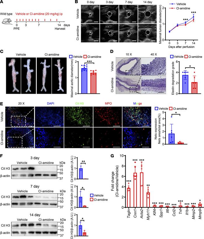 Inhibition of NETs alleviates elastase-induced AAA in mice.
(A) Schemati...