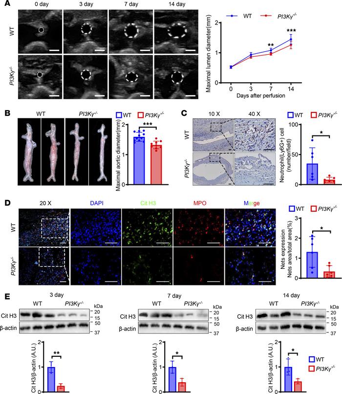 PI3Kγ knockout reduces neutrophil infiltration and NET formation and imp...