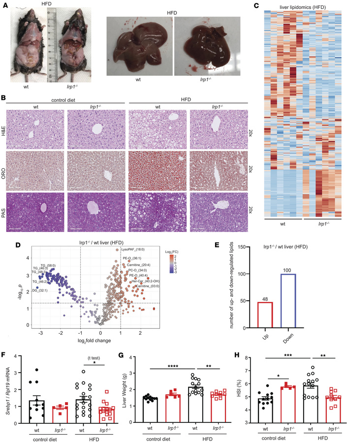 
Irp1–/– mice are protected against high fat diet–induced liver steatosi...