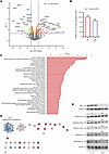 Altered mitochondrial proteome in the liver of Irp1–/– mice.