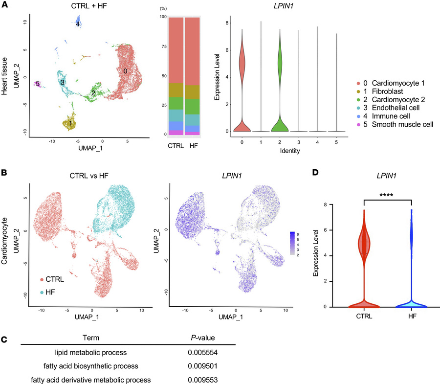 Single-cell analysis identifies cardiac LPIN1.
(A) Uniform Manifold Appr...