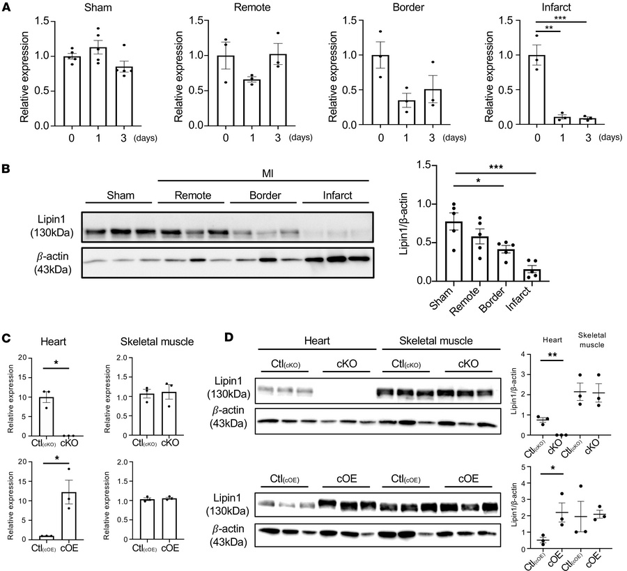 
Lpin1/lipin1 expression levels after MI surgery.
(A) Lpin1 mRNA express...