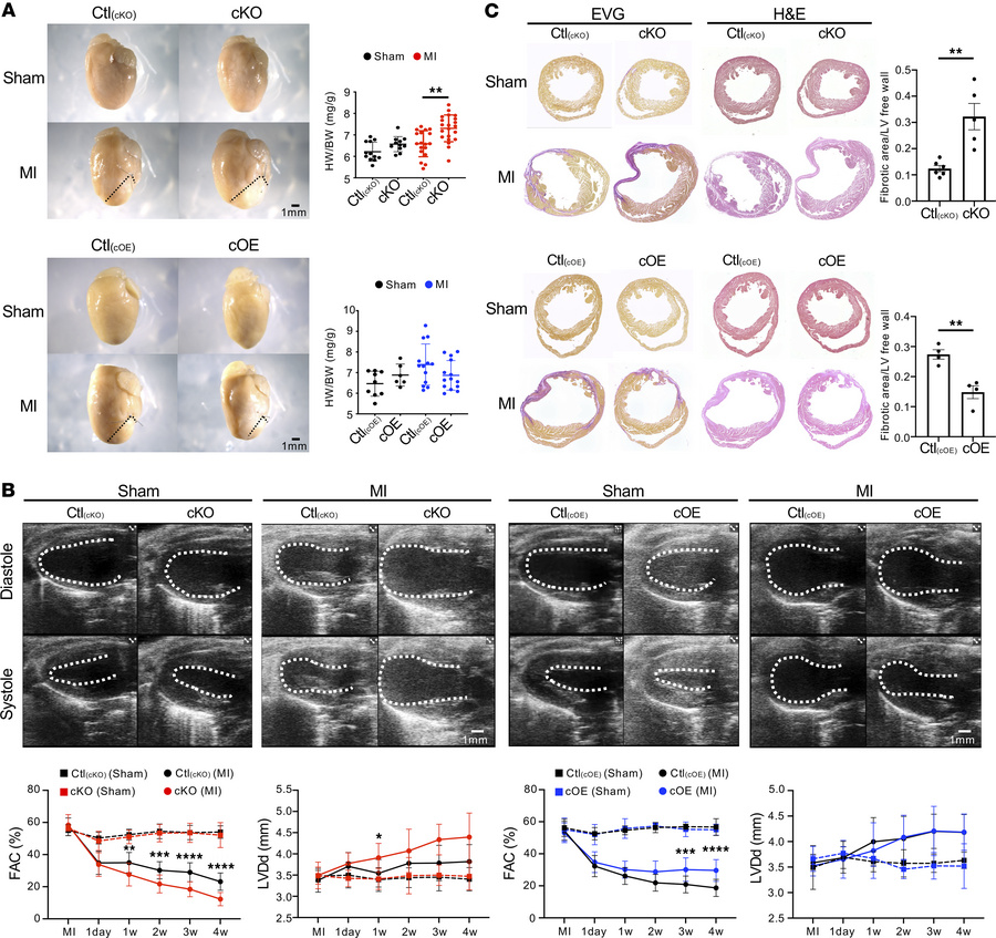 Cardiac function dynamics after MI surgery.
(A) Four weeks after MI, cKO...
