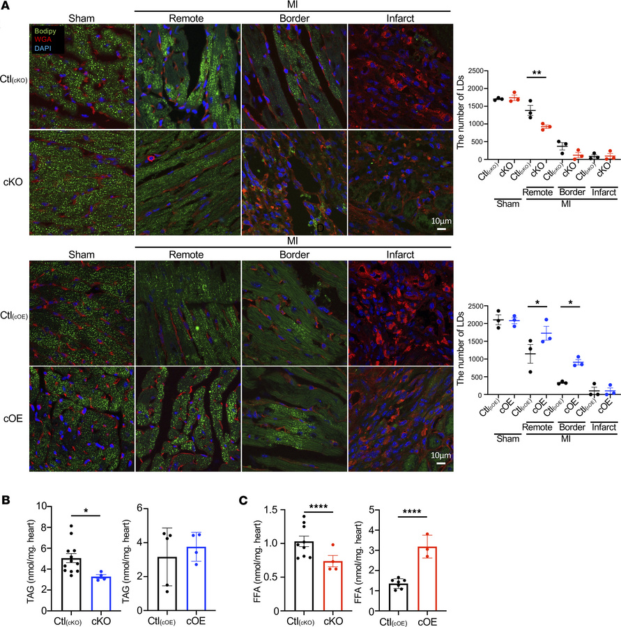 Accumulation of lipid droplets in infarcted hearts.
(A) One week after M...