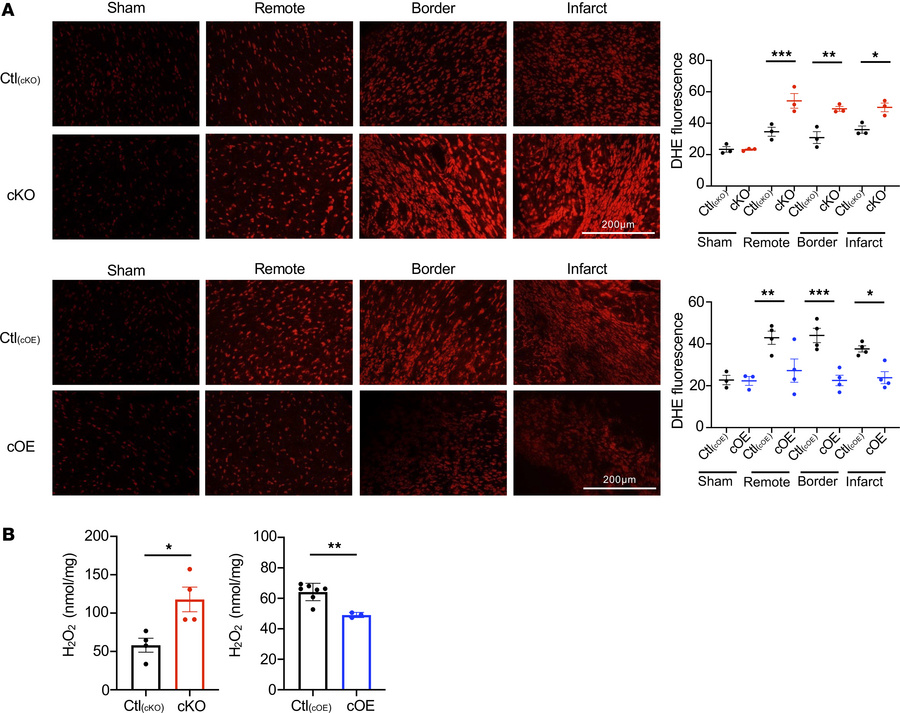 Oxidative stress after MI surgery.
(A) Examination of DHE fluorescence i...