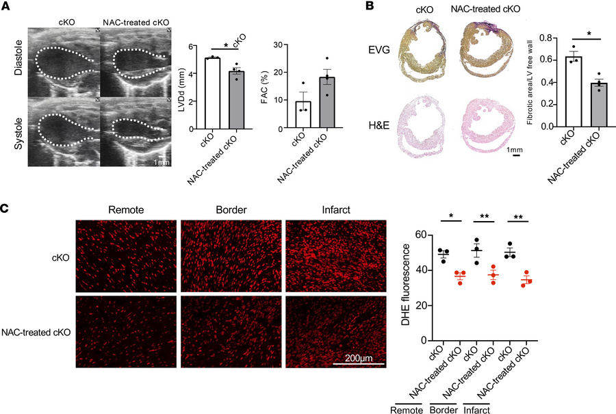 NAC treatment in cKO mice after MI.
(A) Echocardiographic analysis of ca...