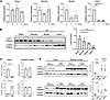 Lpin1/lipin1 expression levels after MI surgery.