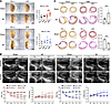 Cardiac function dynamics after MI surgery.