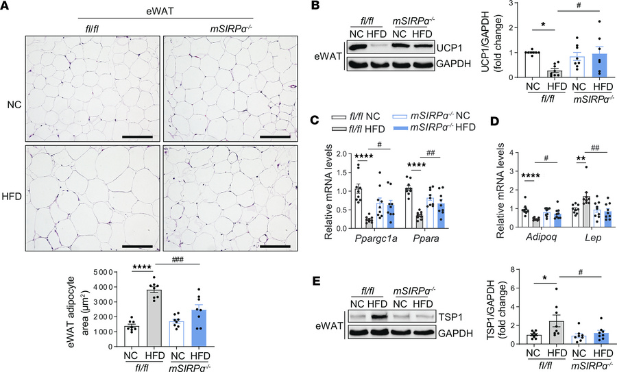 Blocking SIRPα in muscle improves white adipose tissue metabolism.
Five-...