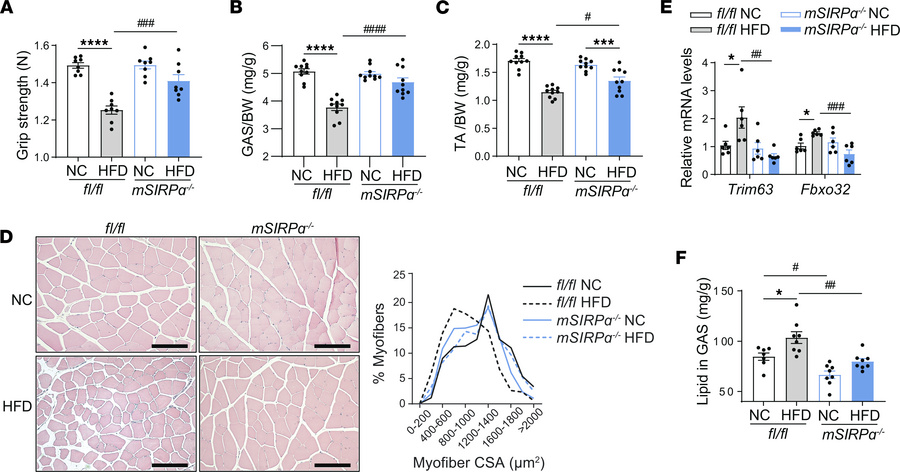 Blocking muscle SIRPα suppresses ectopic lipid accumulation while attenu...