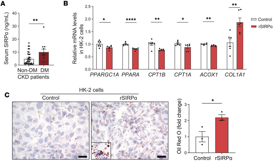 Type 2 diabetes stimulates circulating serum SIRPα in chronic kidney dis...