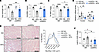 Blocking muscle SIRPα suppresses ectopic lipid accumulation while attenuati
