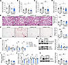 SIRPα suppression in skeletal muscle mitigates HFD-induced renal fibrosis a