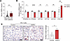 Type 2 diabetes stimulates circulating serum SIRPα in chronic kidney diseas