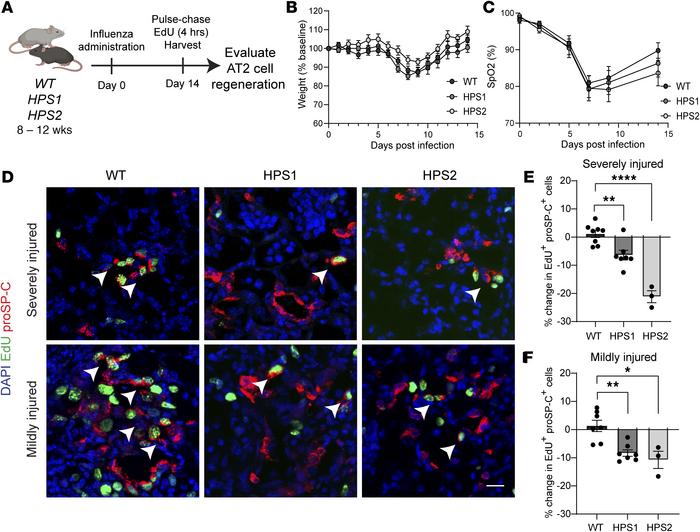 Impaired regeneration of HPS AT2 cells after acute influenza injury.
(A)...