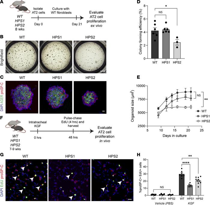 Impaired proliferation of HPS AT2 cells ex vivo and in vivo.
(A) Schemat...