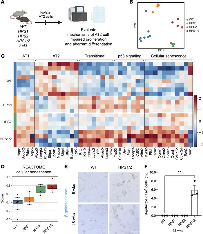Transcriptomic analysis suggests aberrant differentiation and p53-mediat...