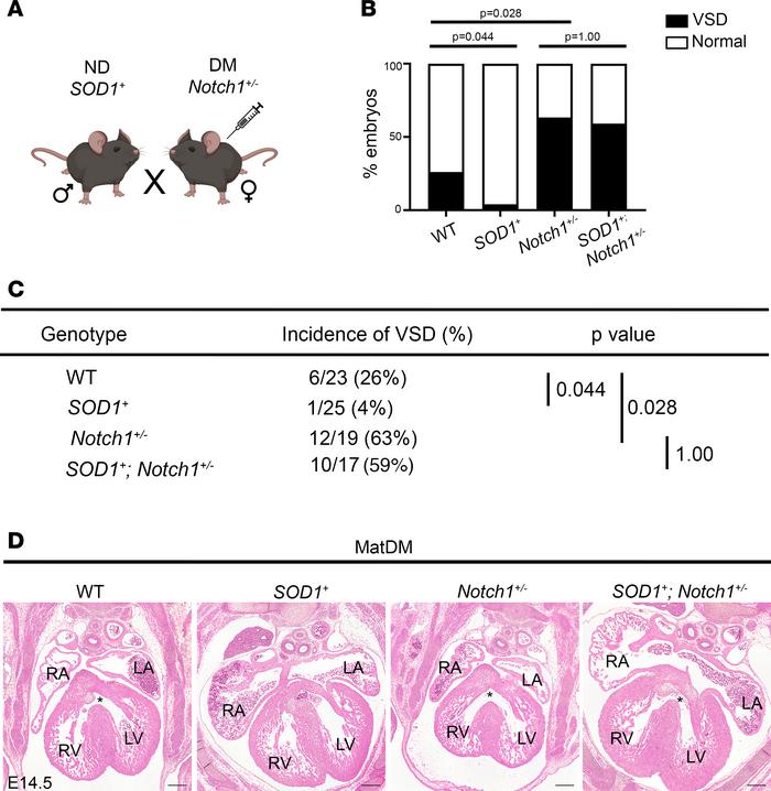 
SOD1 overexpression does not rescue matDM-associated VSD in the setting...