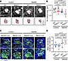 matDM impairs AV cushion size in Notch1-haploinsufficient embryonic hearts.