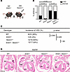 SOD1 overexpression does not rescue matDM-associated VSD in the setting of