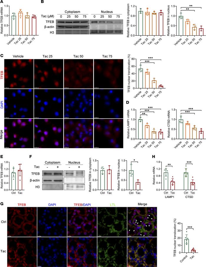 TFEB cytosol-to-nucleus translocation is inhibited in vitro and in vivo....