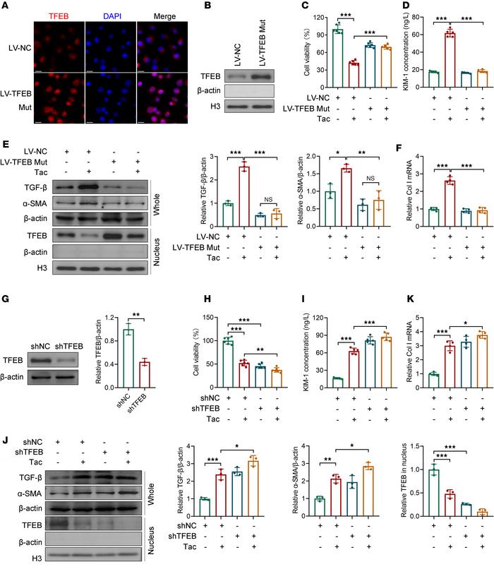 TFEB gain and loss of function modifies the effect of Tac in HK-2 cells....