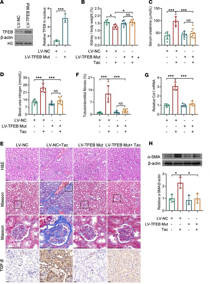 TICN is alleviated by the activation of TFEB in vivo.
(A) TFEB nuclear t...