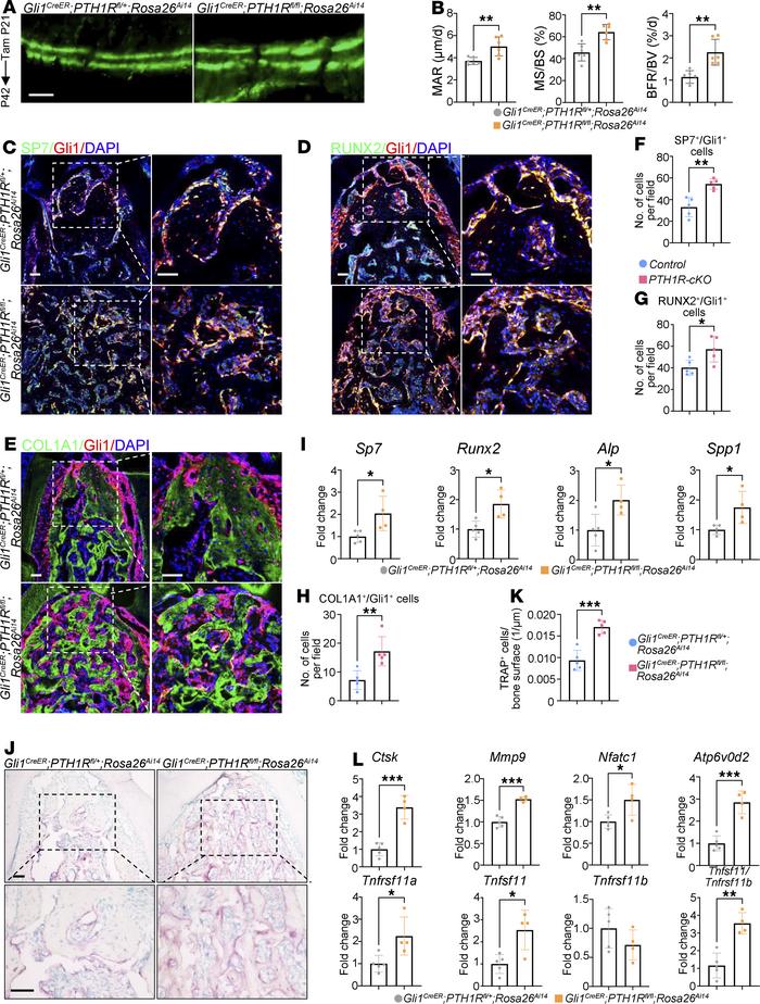 Deletion of PTH1R in Gli1+ lineage cells stimulates bone remodeling.
(A)...