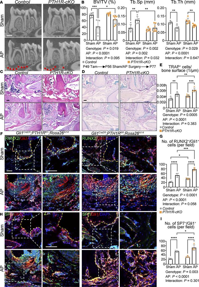 
Gli1CreER PTH1Rfl/fl mice exhibit restricted periapical lesion because ...