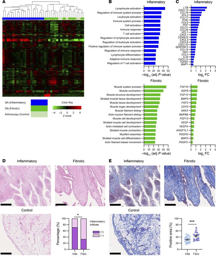Classification of human knee OA synovium by RNA-Seq and histological eva...