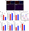 Stra6 loss induces mitochondrial dysfunction.