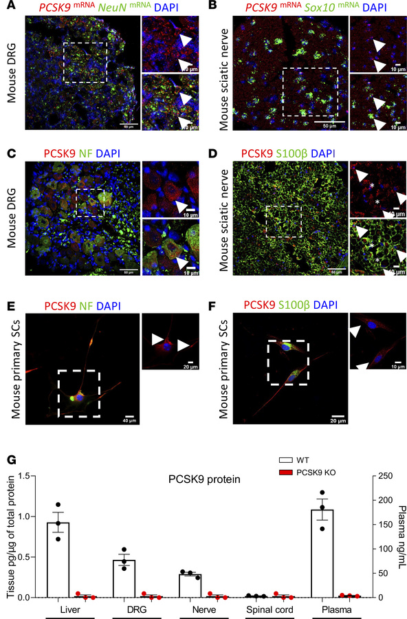 
PCSK9 expression in the peripheral nervous system of mice.
(A and B) PC...