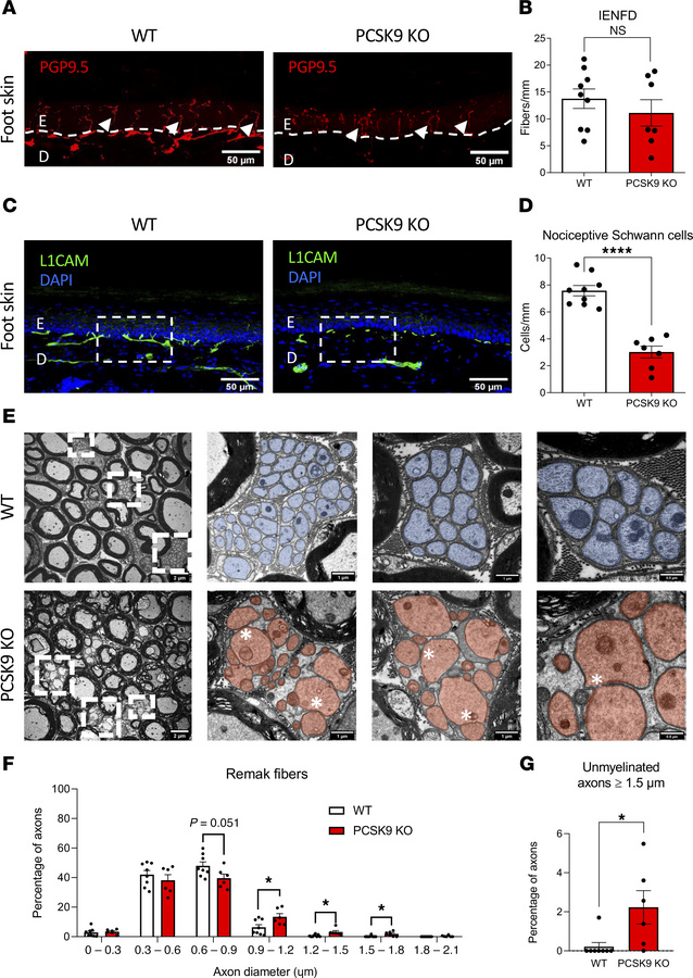 
PCSK9 deficiency is associated with loss of nociceptive Schwann cells a...