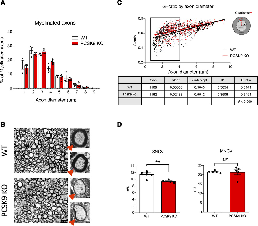 
PCSK9 deficiency is associated with structural and physiological change...