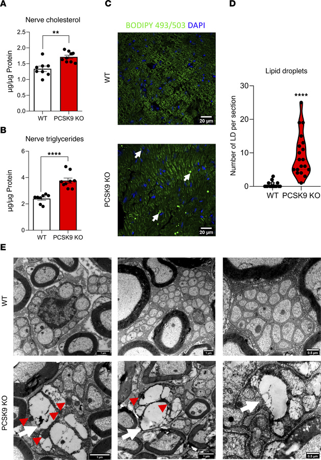 
PCSK9 deficiency results in increased lipid concentration in peripheral...