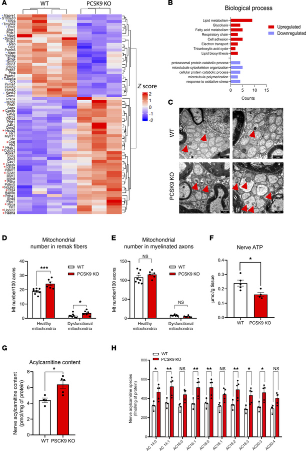 Proteomic profile and mitochondrial abnormalities of PCSK9-KO nerves.
(A...