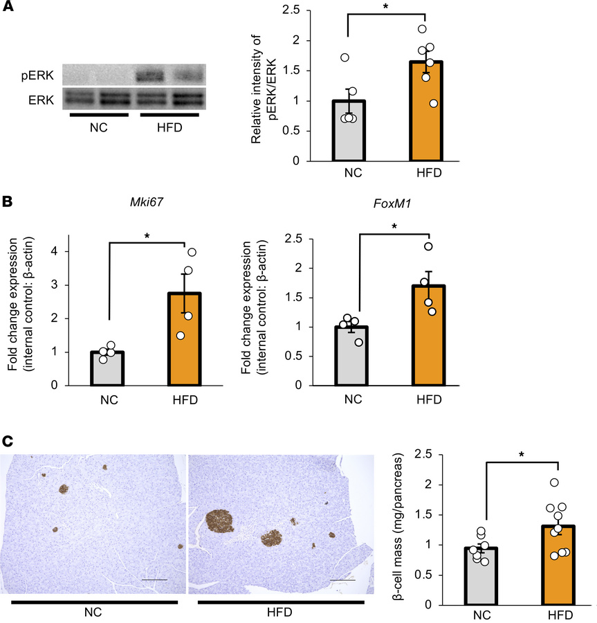 Hepatic ERK activation and β cell proliferation are induced in mice with...