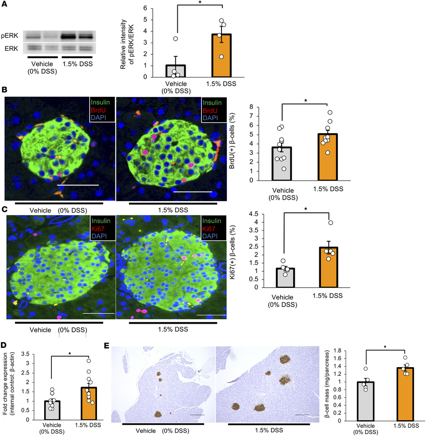 Hepatic ERK pathway activation and β cell proliferation are enhanced in ...