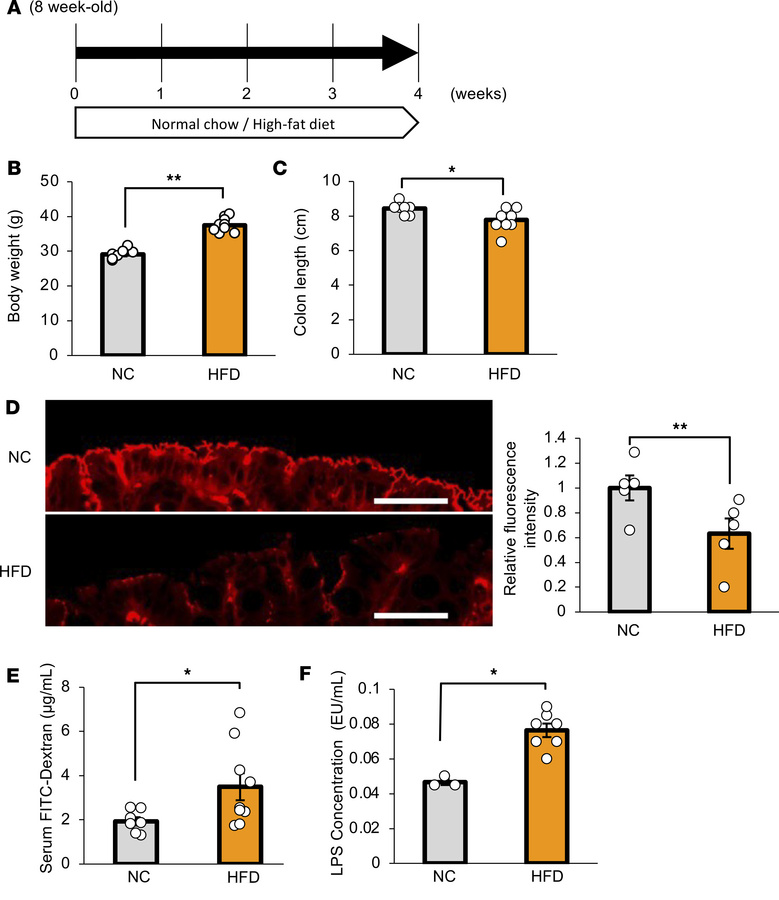 Colonic inflammation was induced in mice with HFD-induced obesity.
(A) S...