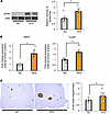 Hepatic ERK activation and β cell proliferation are induced in mice with HF