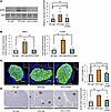 Blockade of colonic inflammation suppresses hepatic ERK activation and β ce