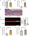 Colonic inflammation and colonic intestinal barrier disruption are induced